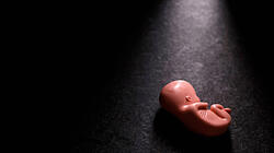 Abtreibungsstatistik für 2025